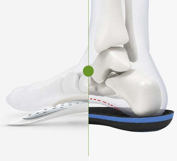Split-screen anatomical graphic demonstrating arch and heel support alignment using a foot skeleton bone model over two distinct orthotic shoe inserts.