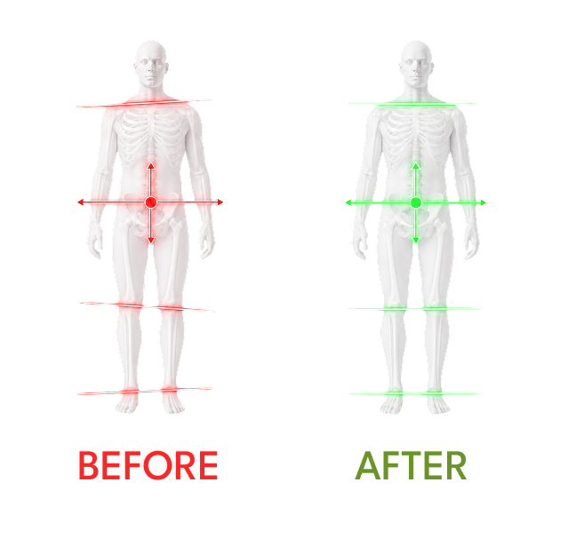 A side-by-side before/after comparison on a white background. The left figure is labeled BEFORE in red and shows a white anatomical human model with red measurement lines across the body.